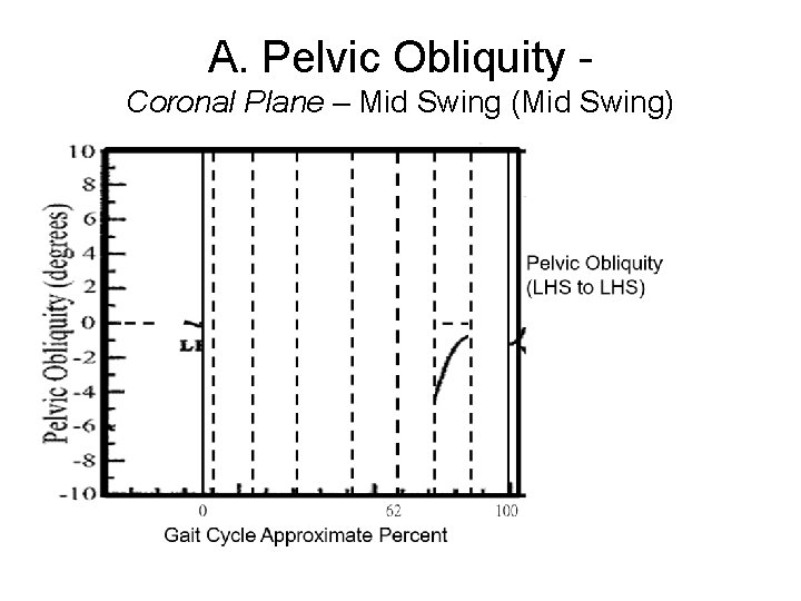 A. Pelvic Obliquity Coronal Plane – Mid Swing (Mid Swing) 