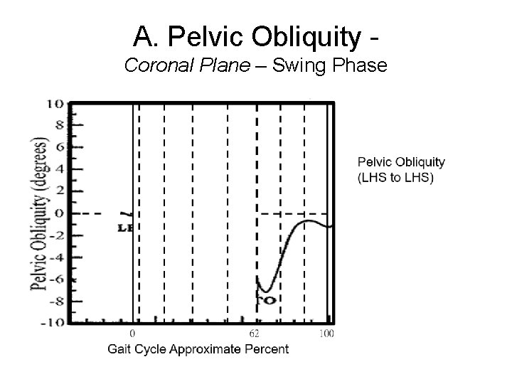 A. Pelvic Obliquity Coronal Plane – Swing Phase 