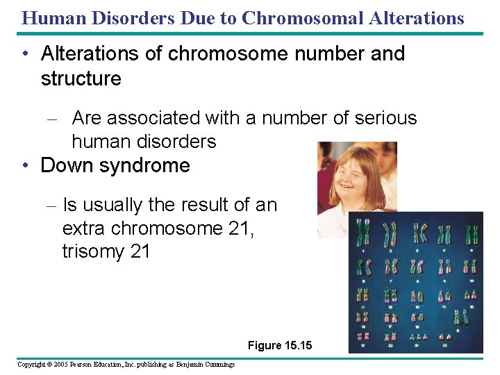 Human Disorders Due to Chromosomal Alterations • Alterations of chromosome number and structure –