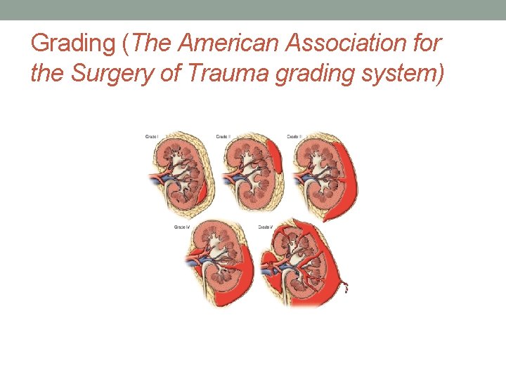 Grading (The American Association for the Surgery of Trauma grading system) Grading (The American Association for the Surgery of Trauma grading system)