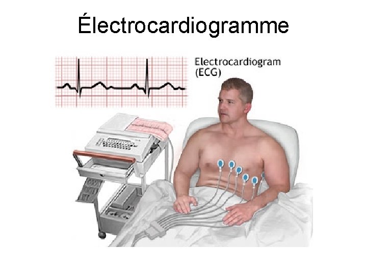 Électrocardiogramme 