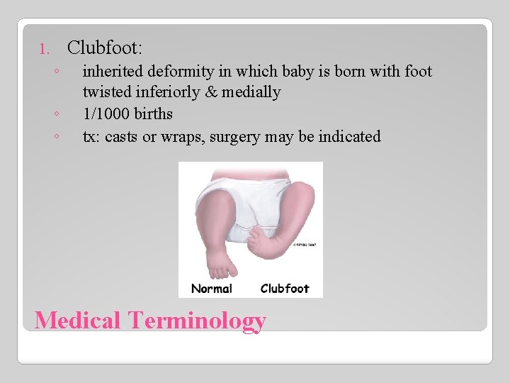 Clubfoot: 1. ◦ ◦ ◦ inherited deformity in which baby is born with foot