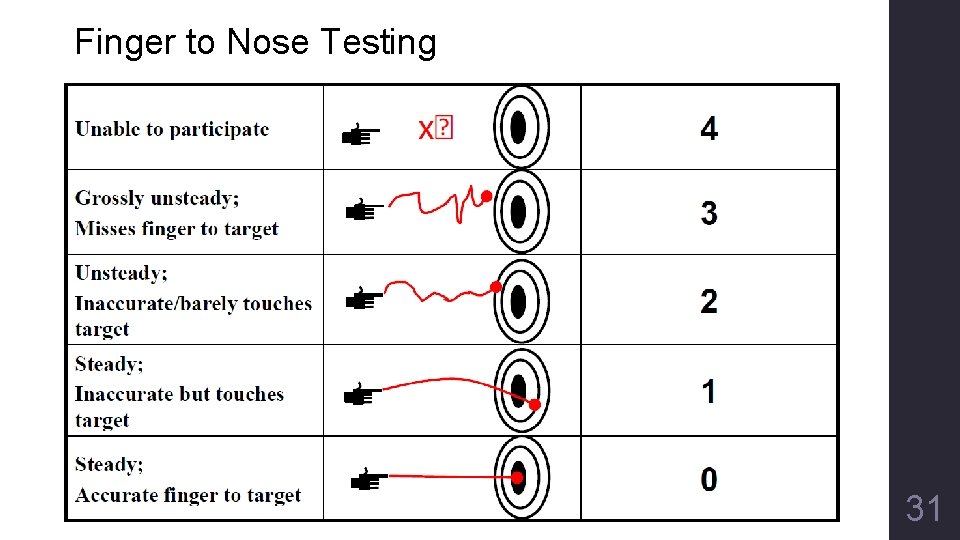 Finger to Nose Testing 31 