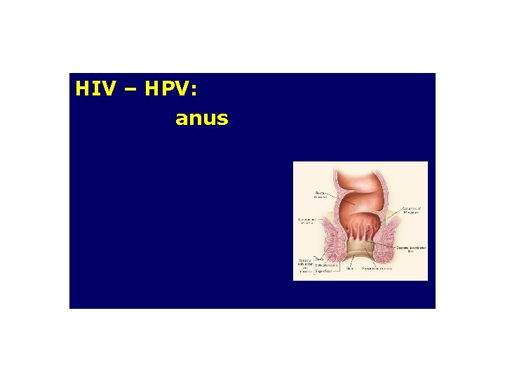 HIV – HPV: anus HIV – HPV: anus