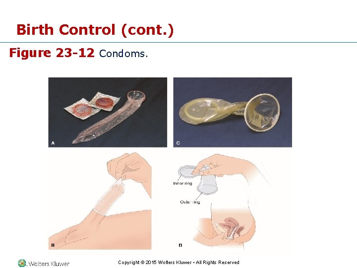 Birth Control (cont. ) Figure 23 -12 Condoms. Copyright © 2015 Wolters Kluwer • Birth Control (cont. ) Figure 23 -12 Condoms. Copyright © 2015 Wolters Kluwer •