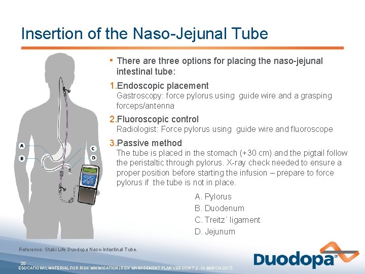 Insertion of the Naso-Jejunal Tube • There are three options for placing the naso-jejunal