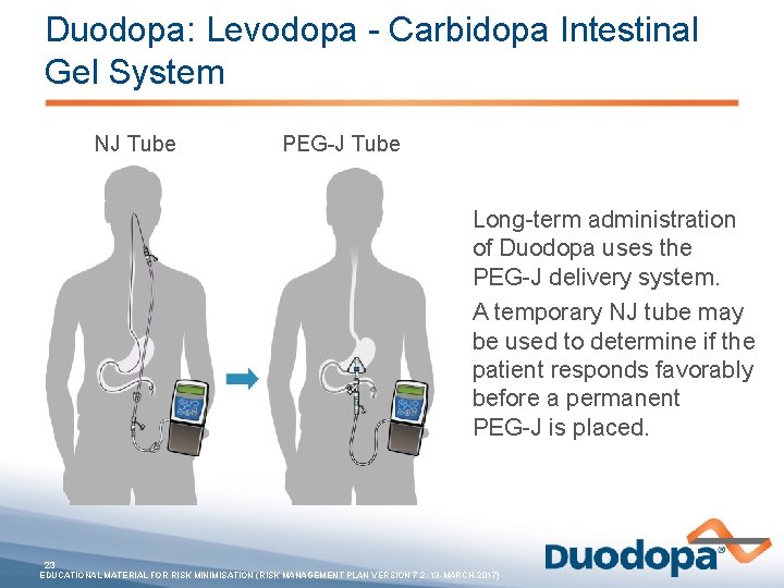 Duodopa: Levodopa - Carbidopa Intestinal Gel System NJ Tube PEG-J Tube Long-term administration of