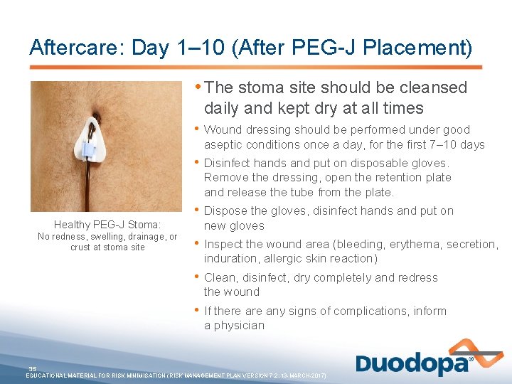 Aftercare: Day 1– 10 (After PEG-J Placement) • The stoma site should be cleansed