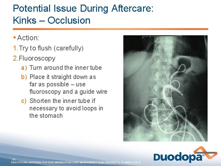 Potential Issue During Aftercare: Kinks – Occlusion • Action: 1. Try to flush (carefully)