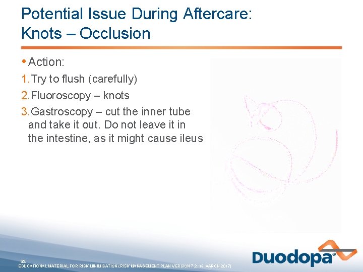 Potential Issue During Aftercare: Knots – Occlusion • Action: 1. Try to flush (carefully)