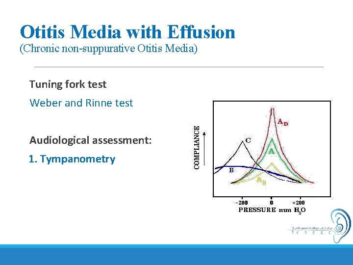 Otitis Media with Effusion (Chronic non-suppurative Otitis Media) Tuning fork test Weber and Rinne