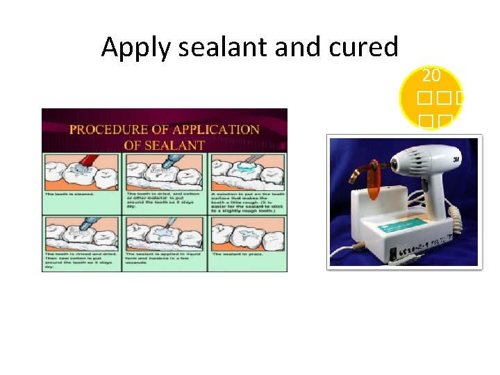 Apply sealant and cured 20 ��� 