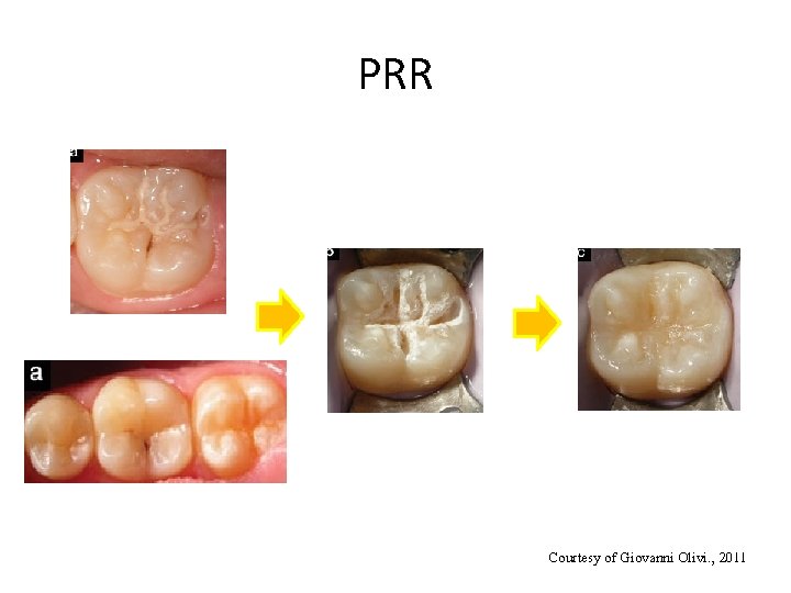 PRR Courtesy of Giovanni Olivi. , 2011 