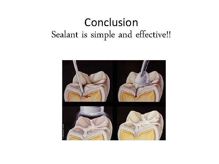 Conclusion Sealant is simple and effective!! 