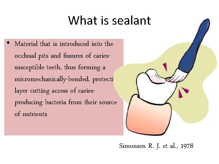 What is sealant • Material that is introduced into the occlusal pits and fissures
