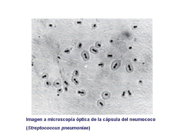 Imagen a microscopía óptica de la cápsula del neumococo (Streptococcus pneumoniae) 