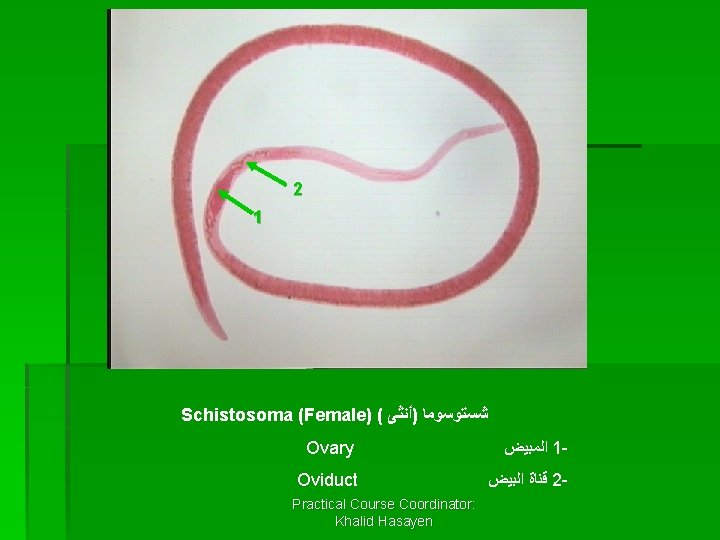 2 1 Schistosoma (Female) ( ﺷﺴﺘﻮﺳﻮﻣﺎ )ﺃﻨﺜﻰ Ovary ﺍﻟﻤﺒﻴﺾ 1 - Oviduct ﻗﻨﺎﺓ ﺍﻟﺒﻴﺾ