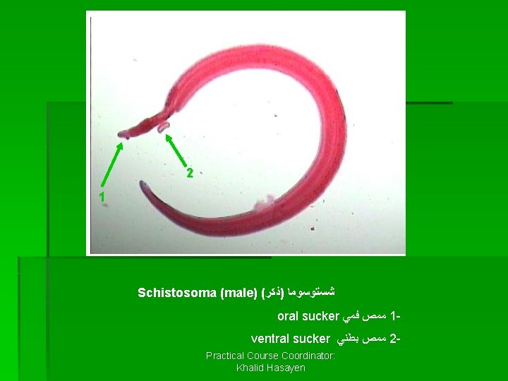 2 1 Schistosoma (male) ( ﺷﺴﺘﻮﺳﻮﻣﺎ )ﺫﻛﺮ oral sucker ﻣﻤﺺ ﻓﻤﻲ 1 ventral sucker