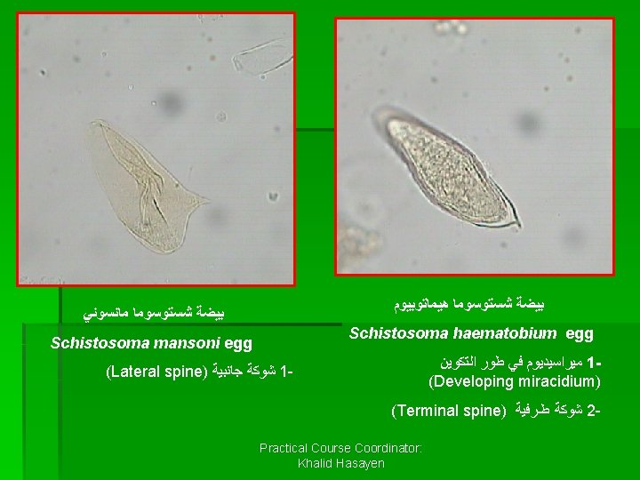 1 1 2 ﺑﻴﻀﺔ ﺷﺴﺘﻮﺳﻮﻣﺎ ﻫﻴﻤﺎﺗﻮﺑﻴﻮﻡ ﺑﻴﻀﺔ ﺷﺴﺘﻮﺳﻮﻣﺎ ﻣﺎﻧﺴﻮﻧﻲ Schistosoma haematobium egg Schistosoma mansoni