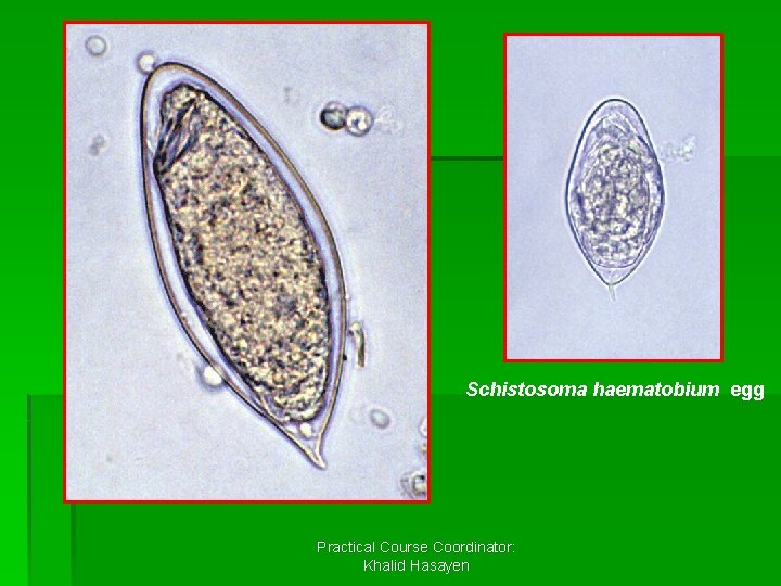 Schistosoma haematobium egg Practical Course Coordinator: Khalid Hasayen 