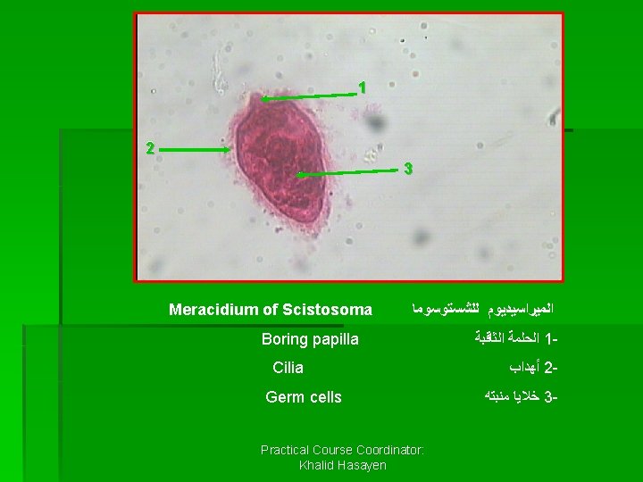 1 2 3 Meracidium of Scistosoma ﺍﻟﻤﻴﺮﺍﺳﻴﺪﻳﻮﻡ ﻟﻠﺸﺴﺘﻮﺳﻮﻣﺎ Boring papilla Cilia Germ cells Practical