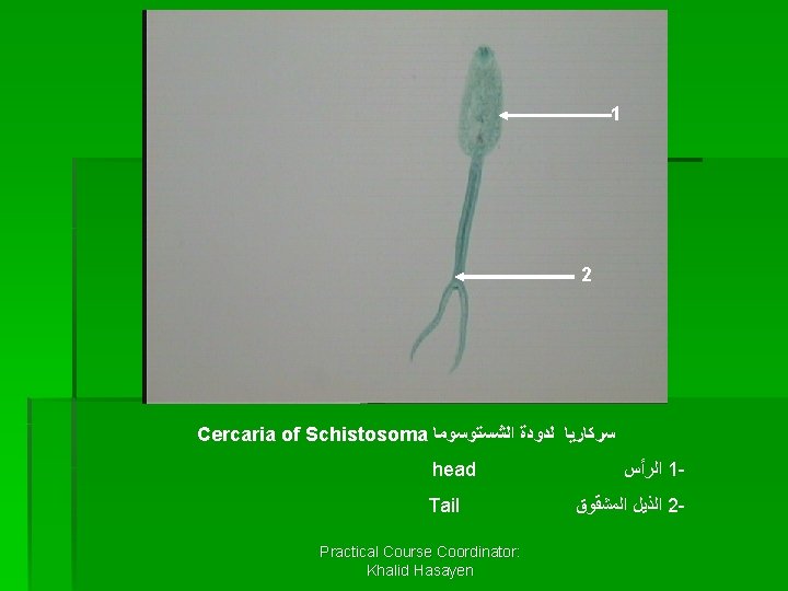 1 2 Cercaria of Schistosoma ﺳﺮﻛﺎﺭﻳﺎ ﻟﺪﻭﺩﺓ ﺍﻟﺸﺴﺘﻮﺳﻮﻣﺎ head Tail Practical Course Coordinator: Khalid