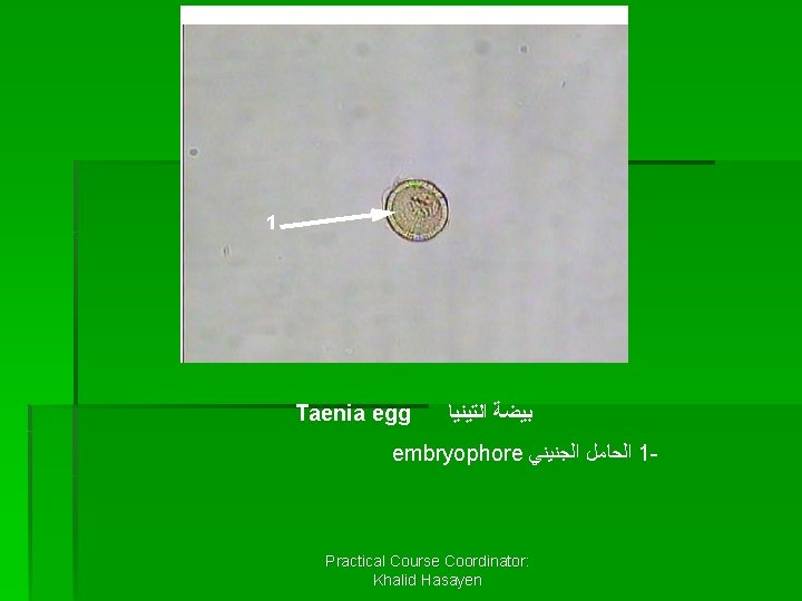 1 Taenia egg ﺑﻴﻀﺔ ﺍﻟﺘﻴﻨﻴﺎ embryophore ﺍﻟﺤﺎﻣﻞ ﺍﻟﺠﻨﻴﻨﻲ 1 - Practical Course Coordinator: Khalid