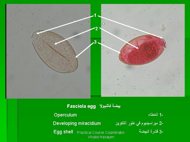 1 2 3 Fasciola egg ﺑﻴﻀﺔ ﻓﺎﺷﻴﻮﻻ Operculum ﺍﻟﻐﻄﺎﺀ 1 - Developing miracidium Egg