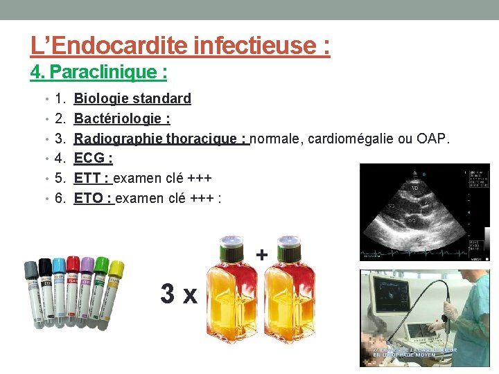 L’Endocardite infectieuse : 4. Paraclinique : • 1. Biologie standard • 2. Bactériologie :