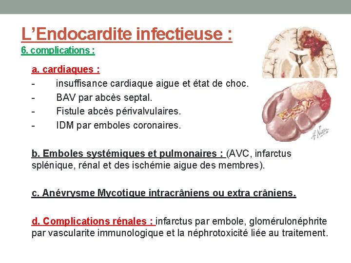 L’Endocardite infectieuse : 6. complications : a. cardiaques : insuffisance cardiaque aigue et état