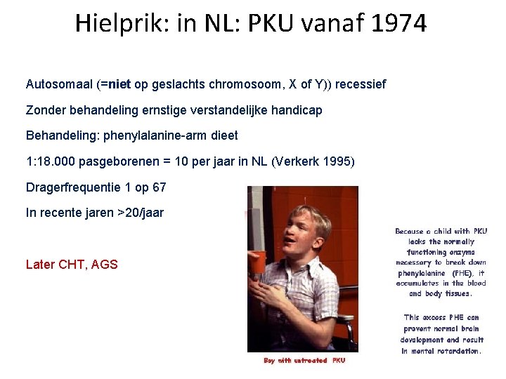 Hielprik: in NL: PKU vanaf 1974 Autosomaal (=niet op geslachts chromosoom, X of Y))