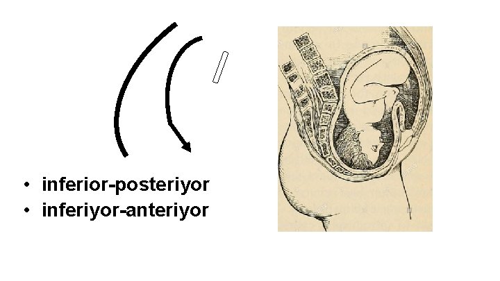 • inferior-posteriyor • inferiyor-anteriyor • inferior-posteriyor • inferiyor-anteriyor