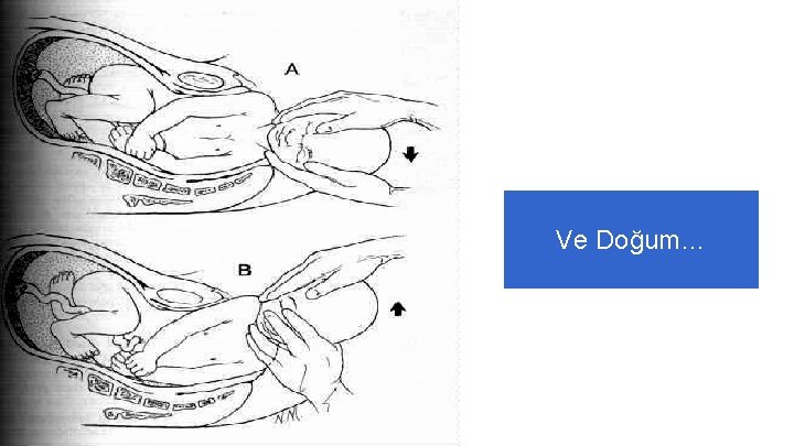Ve Doğum… Ve Doğum…