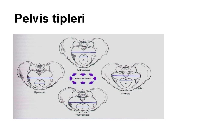 Pelvis tipleri Pelvis tipleri