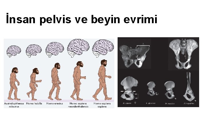 İnsan pelvis ve beyin evrimi İnsan pelvis ve beyin evrimi