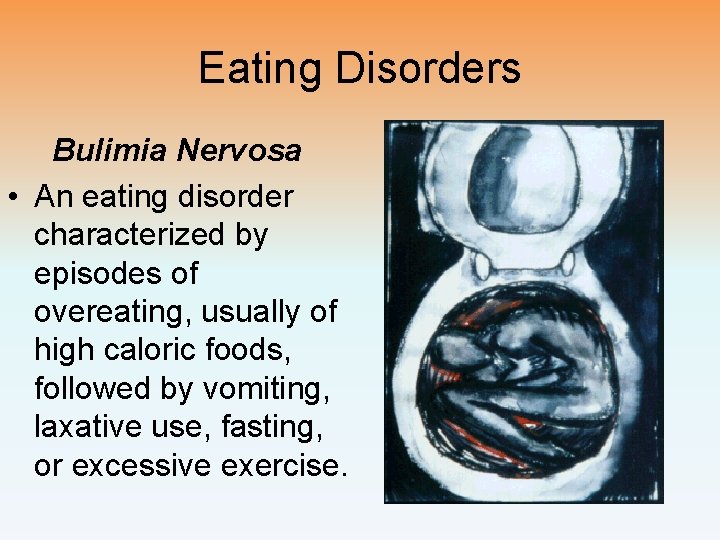 Eating Disorders Bulimia Nervosa • An eating disorder characterized by episodes of overeating, usually