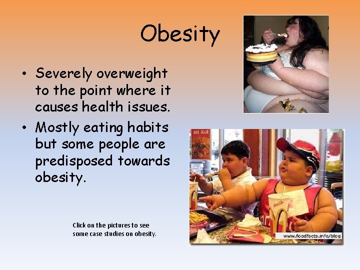 Obesity • Severely overweight to the point where it causes health issues. • Mostly