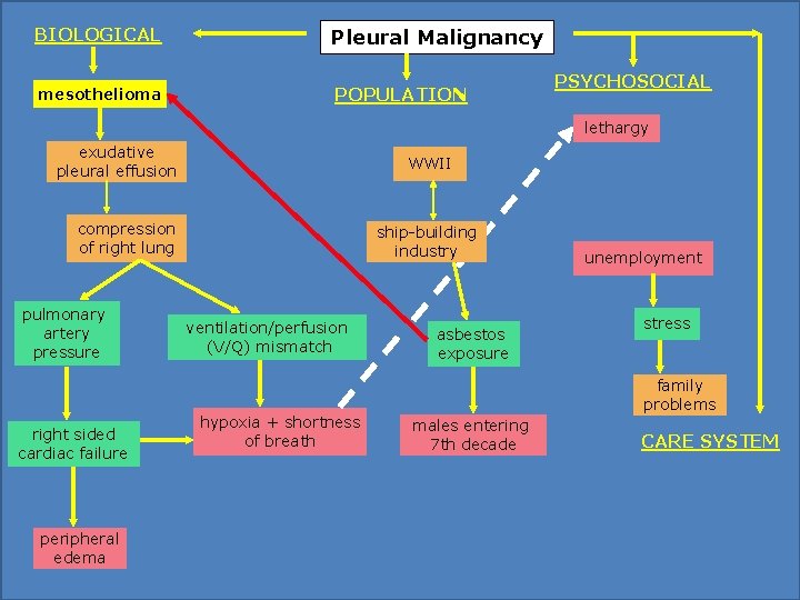 BIOLOGICAL Pleural Malignancy mesothelioma POPULATION PSYCHOSOCIAL lethargy exudative pleural effusion WWII compression of right BIOLOGICAL Pleural Malignancy mesothelioma POPULATION PSYCHOSOCIAL lethargy exudative pleural effusion WWII compression of right