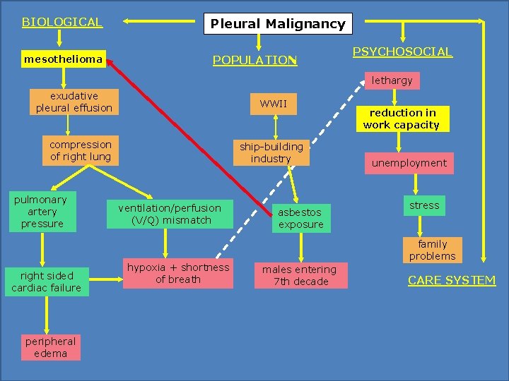 BIOLOGICAL Pleural Malignancy mesothelioma POPULATION PSYCHOSOCIAL lethargy exudative pleural effusion WWII compression of right BIOLOGICAL Pleural Malignancy mesothelioma POPULATION PSYCHOSOCIAL lethargy exudative pleural effusion WWII compression of right