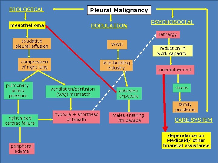 BIOLOGICAL Pleural Malignancy mesothelioma POPULATION PSYCHOSOCIAL lethargy exudative pleural effusion WWII compression of right BIOLOGICAL Pleural Malignancy mesothelioma POPULATION PSYCHOSOCIAL lethargy exudative pleural effusion WWII compression of right