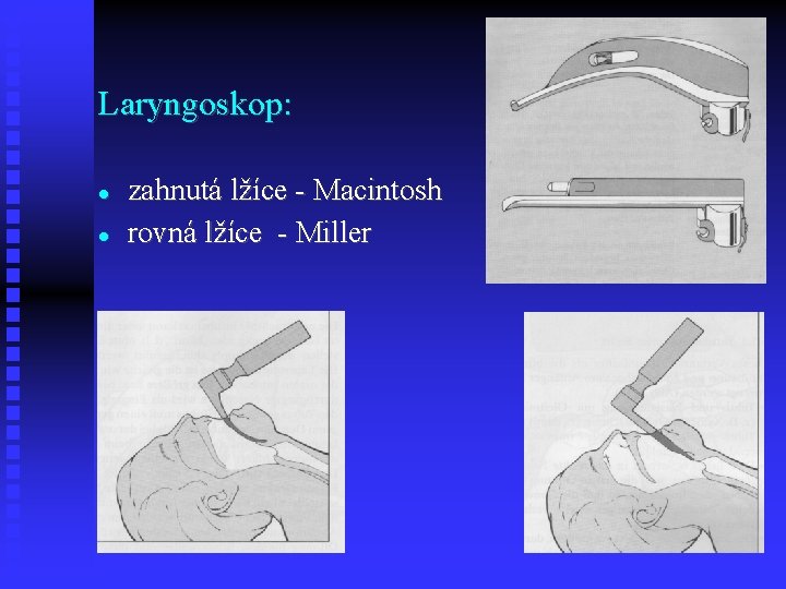 Laryngoskop: zahnutá lžíce - Macintosh rovná lžíce - Miller 