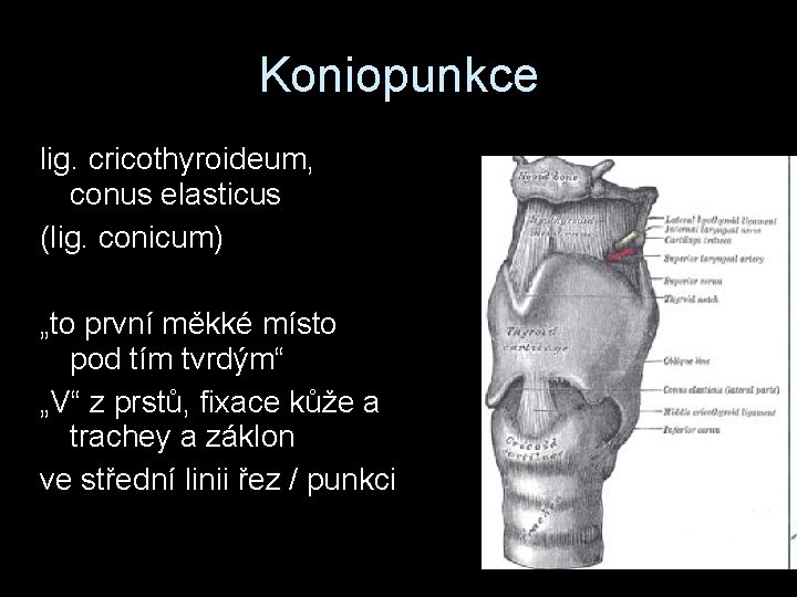 Koniopunkce lig. cricothyroideum, conus elasticus (lig. conicum) „to první měkké místo pod tím tvrdým“
