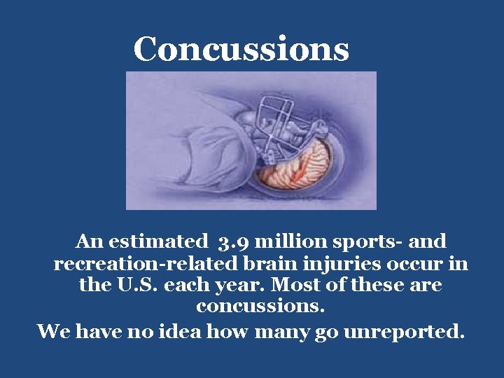 Concussions An estimated 3. 9 million sports- and recreation-related brain injuries occur in the