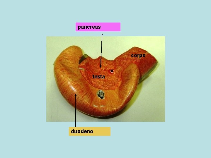 pancreas corpo testa duodeno 