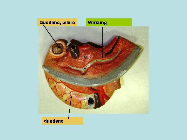 Duodeno, piloro duodeno Wirsung 