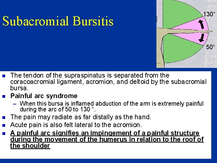 Subacromial Bursitis 130° 50° n n The tendon of the supraspinatus is separated from