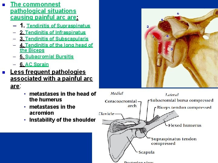 n The commonnest pathological situations causing painful arc are: – 1. Tendinitis of Supraspinatus