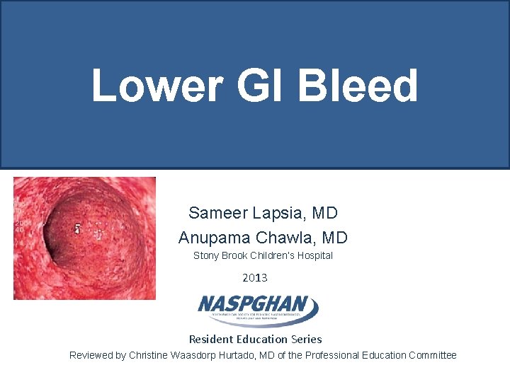 Lower GI Bleed Sameer Lapsia, MD Anupama Chawla, MD Stony Brook Children’s Hospital 2013