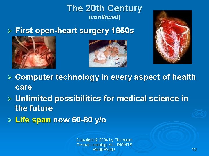 The 20 th Century (continued) Ø First open-heart surgery 1950 s Computer technology in