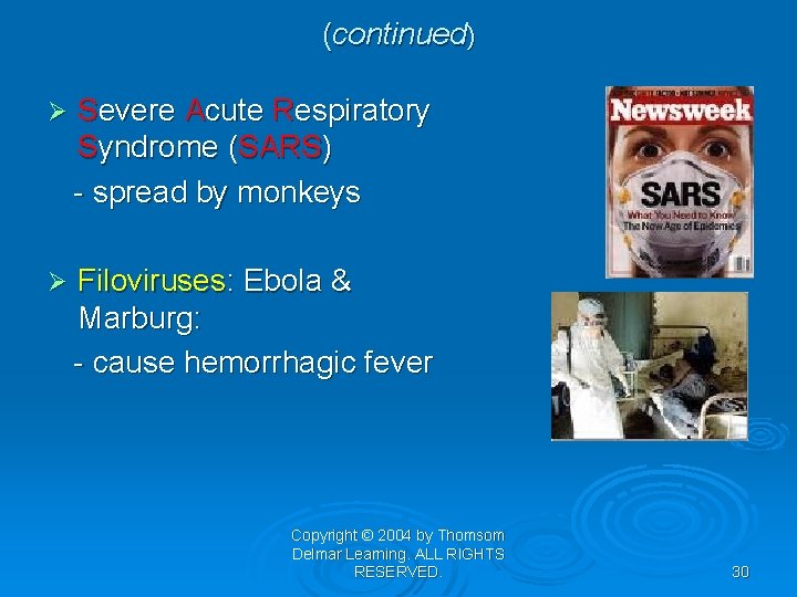 (continued) Ø Severe Acute Respiratory Syndrome (SARS) - spread by monkeys Ø Filoviruses: Ebola